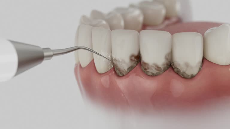 Reliable Emergency Dentist contractor in St. Peter, MN by Smile Center Dentistry
